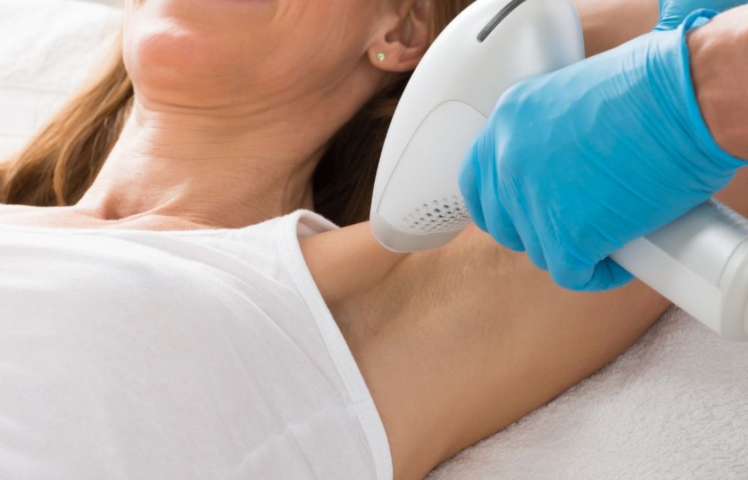 เลเซอร์ขนคืออะไร ช่วยเรื่องอะไรอีกบ้าง นอกจากการกำจัดขน