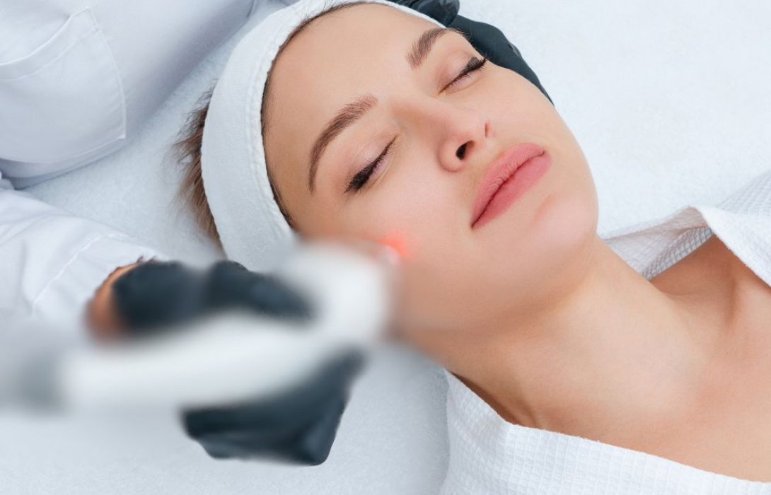 ทำไมต้อง วีบีม เลเซอร์? เลเซอร์คลื่นสีเหลืองที่ช่วยเคลียร์รอยแดงแบบอ่อนโยน